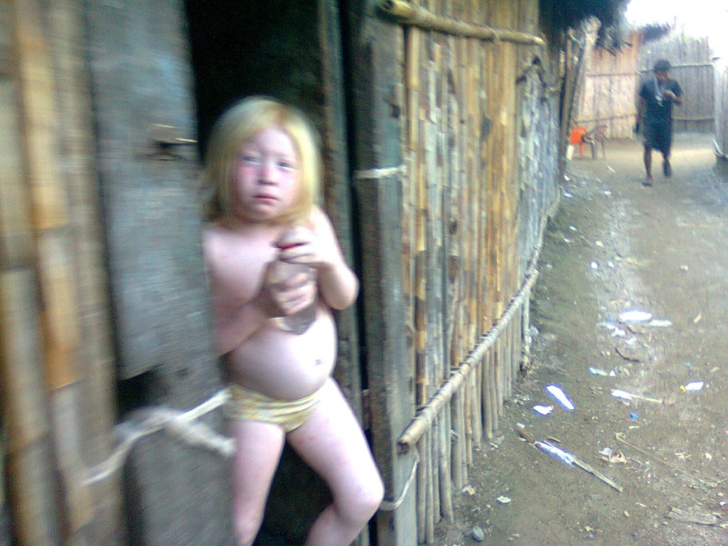 indigena albina